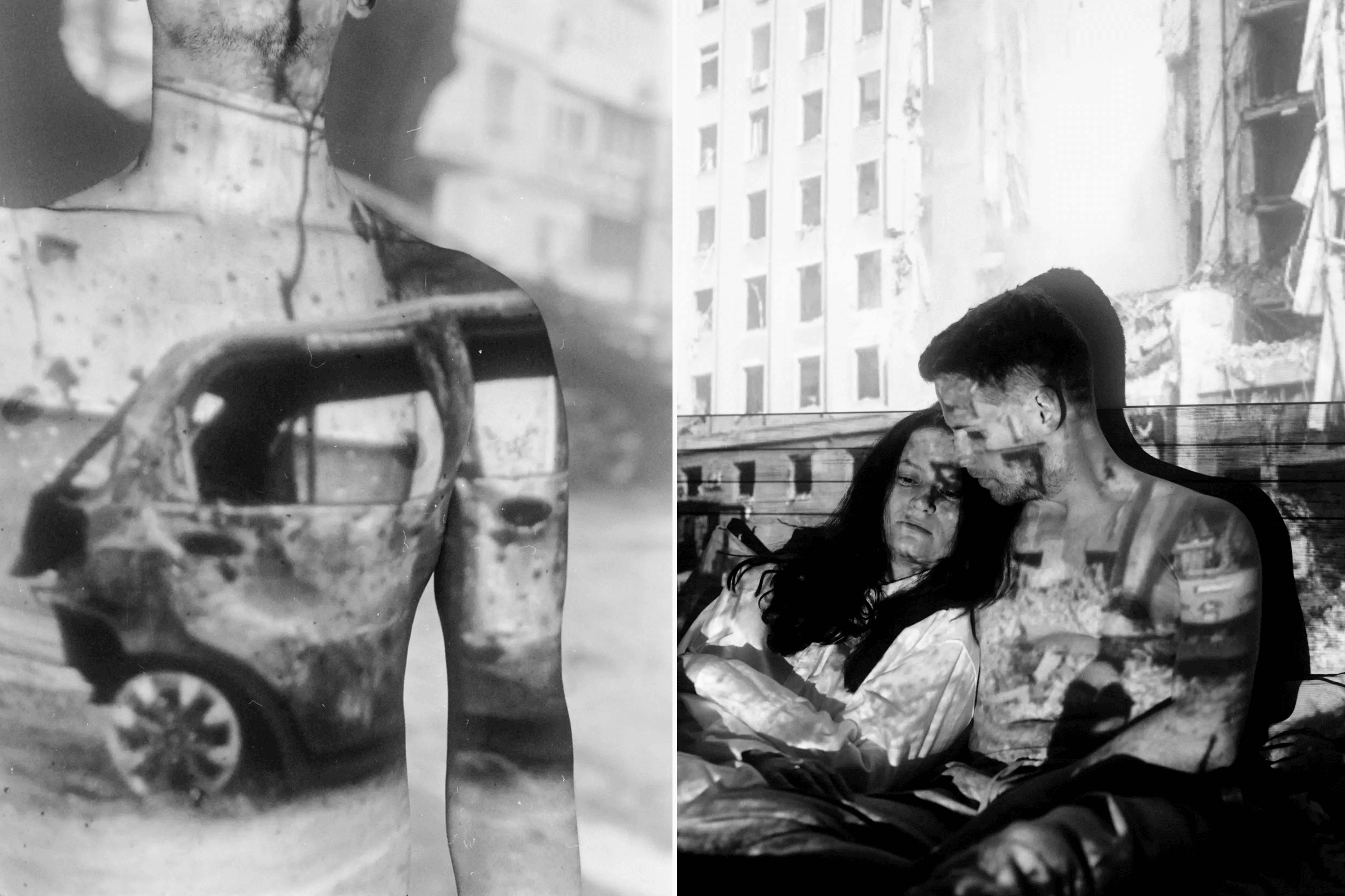 Photo from the series “Tattoos of War.” 2023–2024.